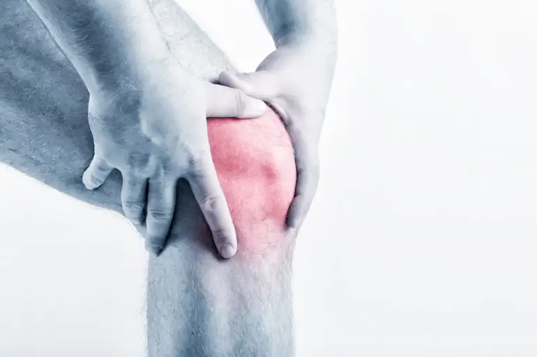 Kopott térdízület illusztrációja gonarthrosis és térd arthrosis esetén